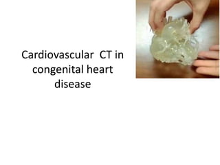 Cardiovascular CT in
congenital heart
disease
 