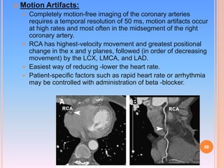 Cardiac CT | PPTX
