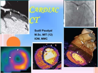 CARDIAC
CT
Sudil Paudyal
M.Sc. MIT (12)
IOM, MMC
1
 