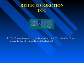 REDUCED EJECTIONREDUCED EJECTION
ECGECG
 The T wave is due to ventricular repolarization. The end of the T waveThe T wave is due to ventricular repolarization. The end of the T wave
marks the end of ventricular systole electrically.marks the end of ventricular systole electrically.
 