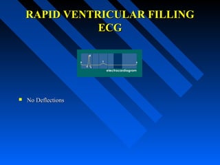 RAPID VENTRICULAR FILLINGRAPID VENTRICULAR FILLING
ECGECG
 No DeflectionsNo Deflections
 