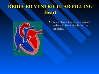 REDUCED VENTRICULAR FILLINGREDUCED VENTRICULAR FILLING
HeartHeart
 Rest of blood that has accumulatedRest of blood that has accumulated
in the atria flows slowly into thein the atria flows slowly into the
ventricles.ventricles.
 