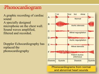Phonocardiogram
A graphic recording of cardiac
sound
A specially designed
microphone on the chest wall.
Sound waves amplified,
filtered and recorded.
Doppler Echocardiography has
replaced the
phonocardiography

 