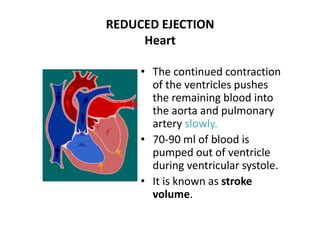 REDUCED EJECTION
Heart
• The continued contraction
of the ventricles pushes
the remaining blood into
the aorta and pulmonary
artery slowly.
• 70-90 ml of blood is
pumped out of ventricle
during ventricular systole.
• It is known as stroke
volume.
 