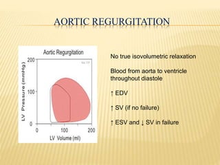 No true isovolumetric relaxation
Blood from aorta to ventricle
throughout diastole
↑ EDV
↑ SV (if no failure)
↑ ESV and ↓ SV in failure
AORTIC REGURGITATION
 