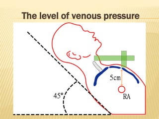 The level of venous pressure
 
