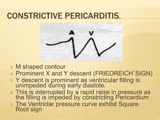  M shaped contour
 Prominent X and Y descent (FRIEDREICH`SIGN)
 Y descent is prominent as ventricular filling is
unimpeded during early diastole.
 This is interrupted by a rapid raise in pressure as
the filling is impeded by constricting Pericardium
 The Ventriclar pressure curve exhibit Square
Root sign
CONSTRICTIVE PERICARDITIS.
 