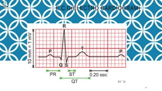 E.C.G(ELECTRO CARDIOGRAM)
17
 