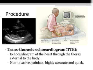 • Trans-esophageal echocardiogram(TEE)
▫ Echocardiogram of the heart through a catheter
placed in the esophagus which is a...