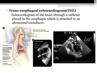 ▫ Invasive and must be performed
under supervision.
• Doppler echocardiography:
▫ Assessment of
Cardiac valve areas and fu...