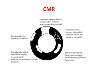 CMR
 