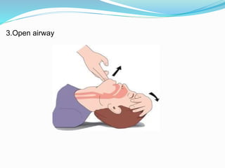 3.Open airway
 