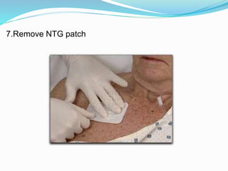 7.Remove NTG patch
 