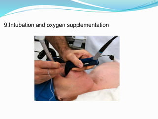 9.Intubation and oxygen supplementation
 