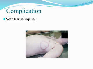 Complication
 Soft tissue injury
 