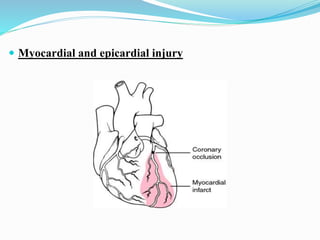  Myocardial and epicardial injury
 
