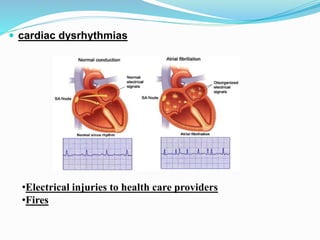  cardiac dysrhythmias
•Electrical injuries to health care providers
•Fires
 