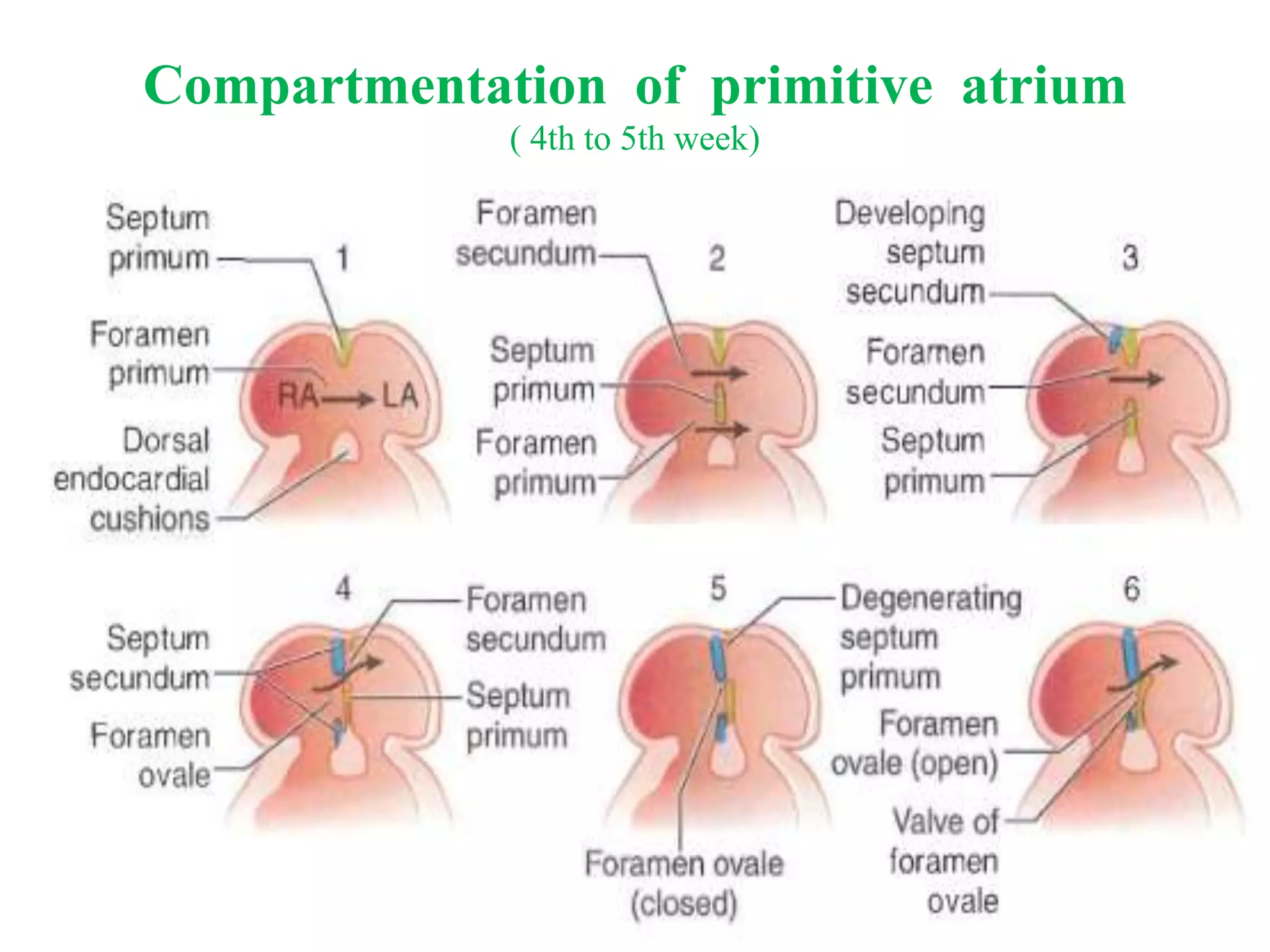 Compartmentation of primitive atrium
( 4th to 5th week)
 