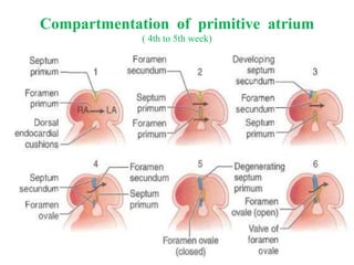 Compartmentation of primitive atrium
( 4th to 5th week)
 