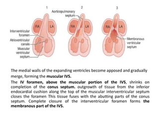 The medial walls of the expanding ventricles become apposed and gradually
merge, forming the muscular IVS.
The IV foramen, above the muscular portion of the IVS, shrinks on
completion of the conus septum. outgrowth of tissue from the inferior
endocardial cushion along the top of the muscular interventricular septum
closes the foramen This tissue fuses with the abutting parts of the conus
septum. Complete closure of the interventricular foramen forms the
membranous part of the IVS.
 