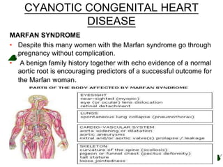 CYANOTIC CONGENITAL HEART
DISEASE
MARFAN SYNDROME
• Despite this many women with the Marfan syndrome go through
pregnancy without complication.
• A benign family history together with echo evidence of a normal
aortic root is encouraging predictors of a successful outcome for
the Marfan woman.
 