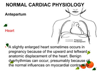 NORMAL CARDIAC PHYSIOLOGY
Antepartum
Heart
• A slightly enlarged heart sometimes occurs in
pregnancy because of the upward and leftward
anatomic displacement of the heart. Benign
dysrhythmias can occur, presumably because of
the normal influences on myocardial contractility.
 