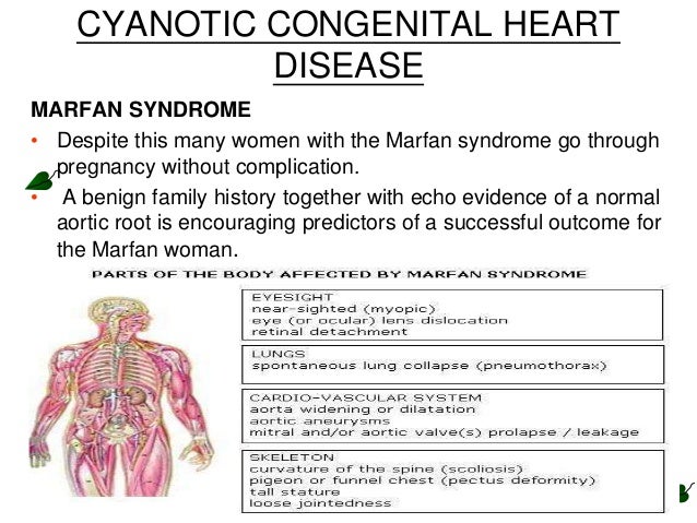 Cardiac diseases complicating pregnancy