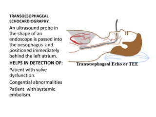 Toe Test Cardiac disorder test | PPTX