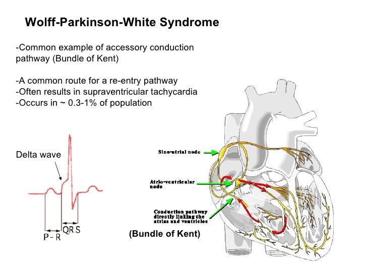Cardiac electrophysiology part ii lecture 4