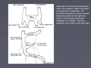 Opposite the dividing atrioventricular
valve, the posterior walls of the atria
are beginning to lateralise. The
symmetrical systemic venous system
biases its growth to the right and
many of its left sided structures
disappear or involute. Thus the
systemic veins drain to the right side.
 