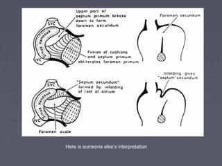 Here is someone else’s interpretation
 