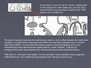 And to finish, a word on the AV valves. Looking back
                                         on this image from a few slides ago, you may have
                                         noticed that the way the septum seals off the “VSD”
                                         space is not a simple line.




The area in question becomes the membranous septum, and is offset towards the mitral valve
resulting in a portion that is interventricular (MSV) and one that is between the LV and the
right atrium (MSA). You will meet this anatomy again in echocardiography and in your
understanding of the atrioventricular septal defects (“canal” defects). It allows the
wedging of the aortic valve between the mitral and tricuspid valves described before.

Well, that’s it. I do hope it has helped. On the next slide I have classified some congenital
malformations on the underlying embryological fault: feel free to give it a try.
 