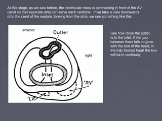 At this stage, as we saw before, the ventricular mass is centralising in front of the AV
canal so that separate atria can serve each ventricle. If we take a view downwards
onto the crest of the septum, looking from the atria, we see something like this:


         anterior
                                                                   See how close the outlet
                                                                   is to the inlet. If the gap
                                                                   between them fails to grow
                                                                   with the rest of the heart, in
                                                                   the fully formed heart the two
                                                  right            will be in continuity.
 