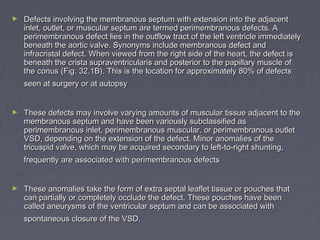 ►   Defects involving the membranous septum with extension into the adjacent
    inlet, outlet, or muscular septum are termed perimembranous defects. A
    perimembranous defect lies in the outflow tract of the left ventricle immediately
    beneath the aortic valve. Synonyms include membranous defect and
    infracristal defect. When viewed from the right side of the heart, the defect is
    beneath the crista supraventricularis and posterior to the papillary muscle of
    the conus (Fig. 32.1B). This is the location for approximately 80% of defects
    seen at surgery or at autopsy


►   These defects may involve varying amounts of muscular tissue adjacent to the
    membranous septum and have been variously subclassified as
    perimembranous inlet, perimembranous muscular, or perimembranous outlet
    VSD, depending on the extension of the defect. Minor anomalies of the
    tricuspid valve, which may be acquired secondary to left-to-right shunting,
    frequently are associated with perimembranous defects


►   These anomalies take the form of extra septal leaflet tissue or pouches that
    can partially or completely occlude the defect. These pouches have been
    called aneurysms of the ventricular septum and can be associated with
    spontaneous closure of the VSD.
 