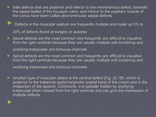 ►   Inlet defects that are posterior and inferior to the membranous defect, beneath
    the septal leaflet of the tricuspid valve, and inferior to the papillary muscle of
    the conus have been called atrioventricular septal defects
►    Defects in the muscular septum are frequently multiple and make up 5% to
    20% of defects found at surgery or autopsy
►   Apical defects are the most common and frequently are difficult to visualize
    from the right ventricle because they are usually multiple with bordering and
    overlying trabeculae and tortuous channels
►   Apical defects are the most common and frequently are difficult to visualize
    from the right ventricle because they are usually multiple with bordering and
    overlying trabeculae and tortuous channels

►   Another type of muscular defect is the central defect (Fig. 32.1B), which is
    posterior to the trabecula septomarginalis (septal band of the crista) and in the
    midportion of the septum. Commonly, it is partially hidden by overlying
    trabeculae when viewed from the right ventricle and can give the impression of
    multiple defects
►
 