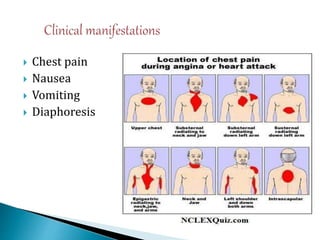  Chest pain
 Nausea
 Vomiting
 Diaphoresis
 