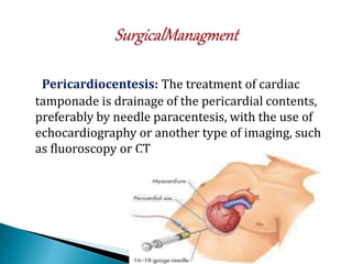 Pericardiocentesis: The treatment of cardiac
tamponade is drainage of the pericardial contents,
preferably by needle paracentesis, with the use of
echocardiography or another type of imaging, such
as fluoroscopy or CT
 