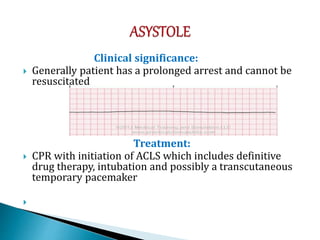 Clinical significance:
 Generally patient has a prolonged arrest and cannot be
resuscitated
Treatment:
 CPR with initiation of ACLS which includes definitive
drug therapy, intubation and possibly a transcutaneous
temporary pacemaker

 