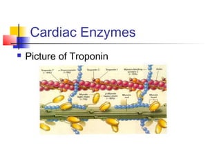 Cardiac Enzymes
 Picture of Troponin
 