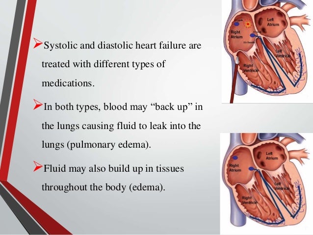 Cardiac failure