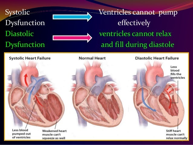 normal lv function heart failure Cardiac Failure