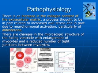 Pathophysiology
There is an increase in the collagen content of
the extracellular matrix, a process thought to be
in part related to increased wall stress and in part
due to neurohormonal activation, particularly of
aldosterone.
There are changes in the microscopic structure of
the failing ventricle with enlargement of
myocytes and a reduced number of tight
junctions between myocytes.
 