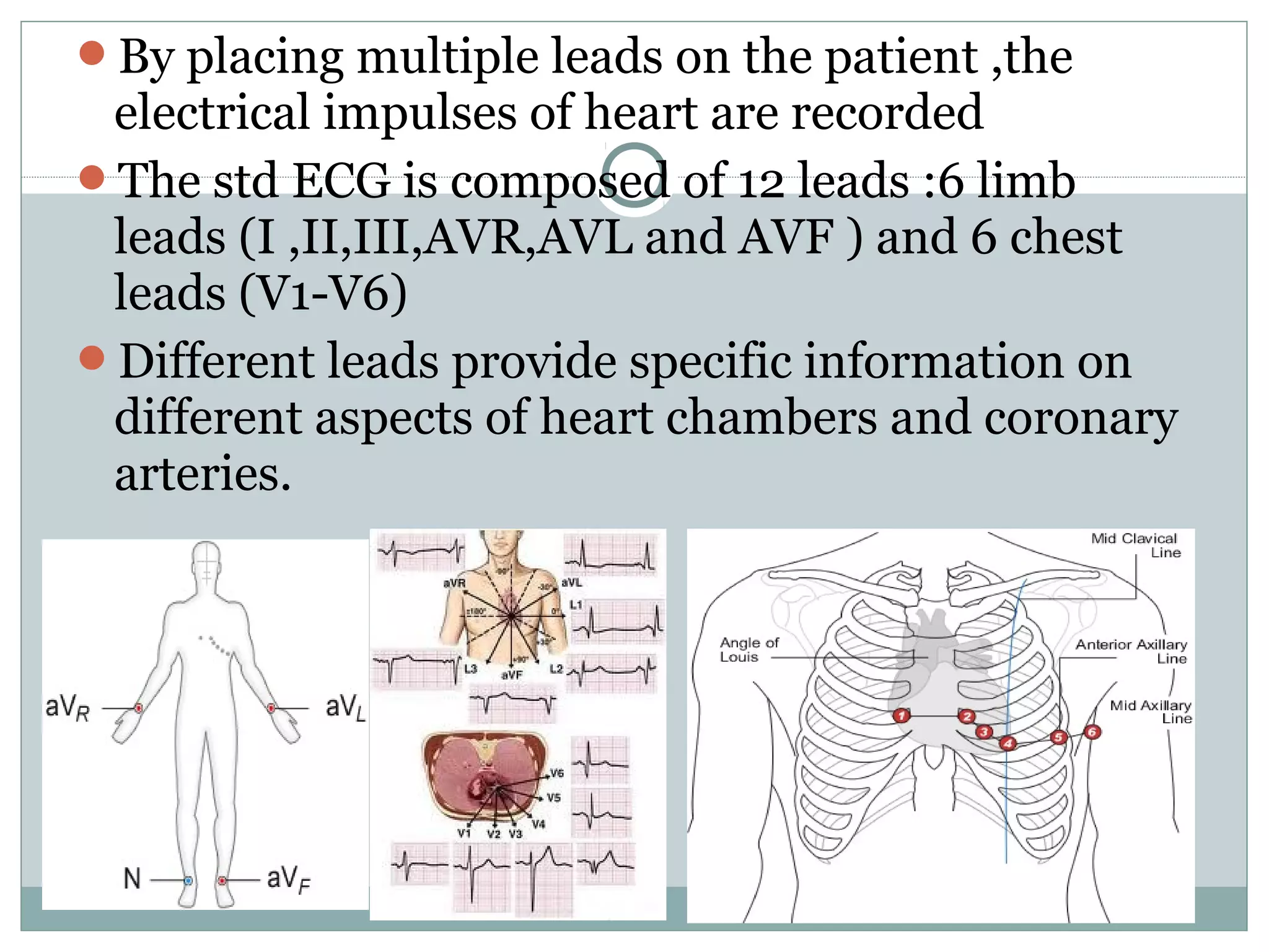 By placing multiple leads on the patient ,the
electrical impulses of heart are recorded
The std ECG is composed of 12 leads :6 limb
leads (I ,II,III,AVR,AVL and AVF ) and 6 chest
leads (V1-V6)
Different leads provide specific information on
different aspects of heart chambers and coronary
arteries.
 