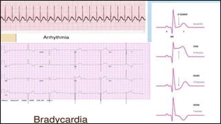 Cardiac function tests | PPTX