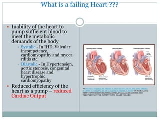 What is a failing Heart ???
 Inability of the heart to
pump sufficient blood to
meet the metabolic
demands of the body
 Systolic - In IHD, Valvular
incompetence,
cardiomyopathy and myoca
rditis etc.
 Diastolic - In Hypertension,
aortic stenosis, congenital
heart disease and
hypertrophic
cardiomyopathy
 Reduced efficiency of the
heart as a pump – reduced
Cardiac Output
BY SCOTT R. SNYDER, BS, NREMT-P, SEAN M. KIVLEHAN, MD, MPH, NREMT-
P, KEVIN T. COLLOPY, BA, FP-C, CCEMT-P, NREMT-P, WEMT ON MAR 29, 2015 -
HTTP://WWW.EMSWORLD.COM/ARTICLE/12053437/DIAGNOSIS-AND-
TREATMENT-OF-THE-PATIENT-WITH-HEART-FAILURE
 