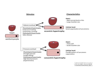 Cardiac hypertrophy - Molecules and drugs involved | PPTX