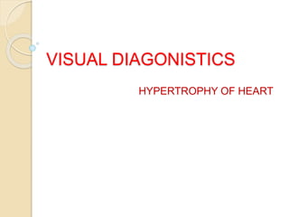 VISUAL DIAGONISTICS
HYPERTROPHY OF HEART
 