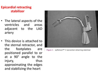 Epicardial retracting
stabilizer
• The lateral aspects of the
ventricles and areas
adjacent to the LAD
artery
• This device is attached to
the sternal retractor, and
the footplates are
positioned parallel to or
at a 90° angle to the
injury, thus
approximating the edges
and stabilizing the heart
 