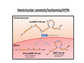 Ventricular stretch/ischemia/HTN
 