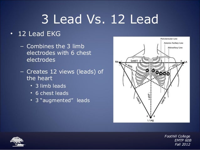 3 channel ecg machine image